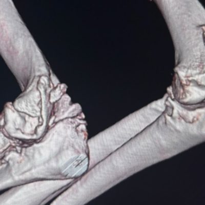 ct1