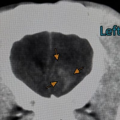 ct2